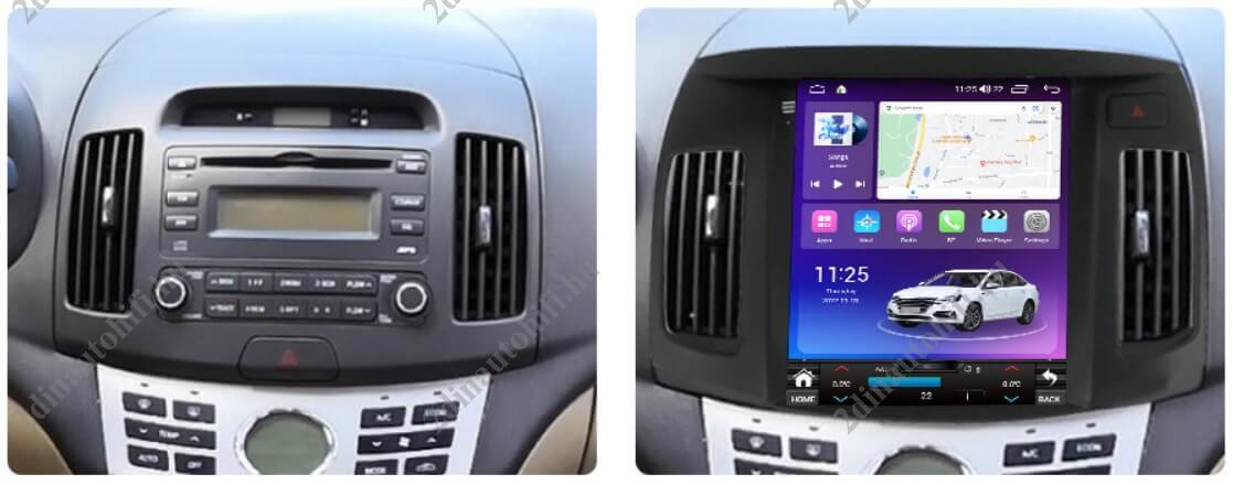 – típus specifikus autóhifi Hyundai Elantra (2008-2016) hatalmas